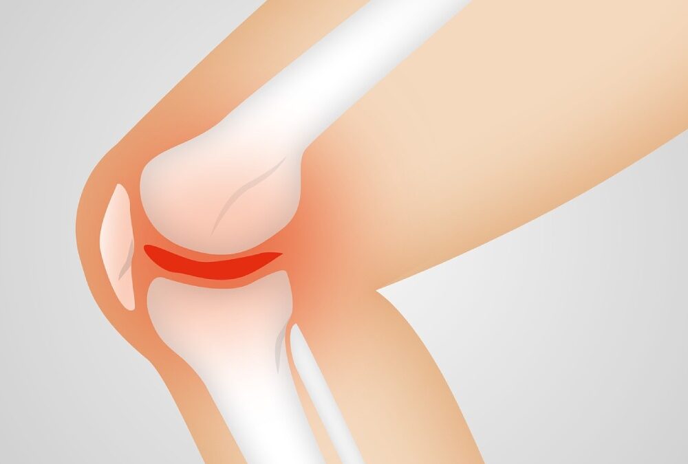 Collagen May Help Reduce The Pain Of Osteoarthritis